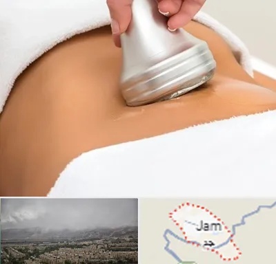 دستگاه لاغری در جم