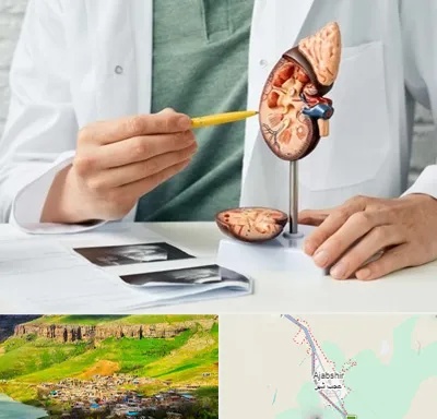 دکتر اورولوژیست در عجب شیر