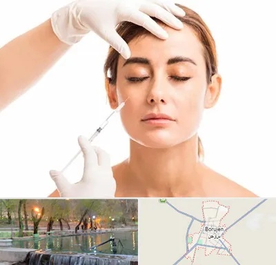 تزریق ژل گونه در بروجن