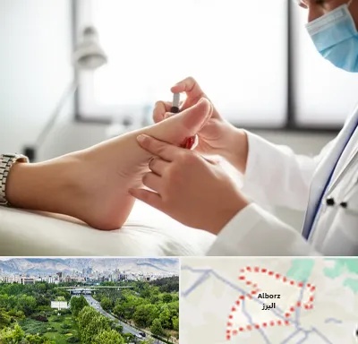 متخصص زخم دیابت در البرز