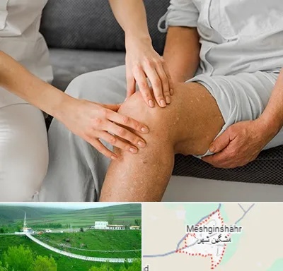 دکتر متخصص استئومیلیت در مشگین شهر