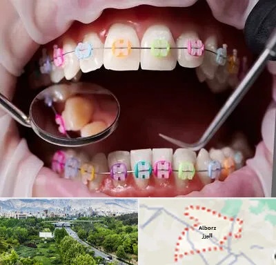 متخصص ارتودنسی در البرز