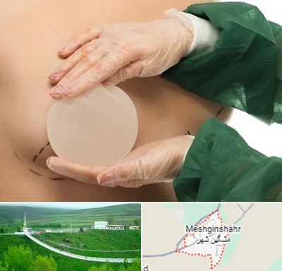 جراحی پروتز سینه در مشگین شهر