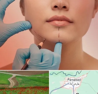 دکتر زیبایی خانم در پارس آباد