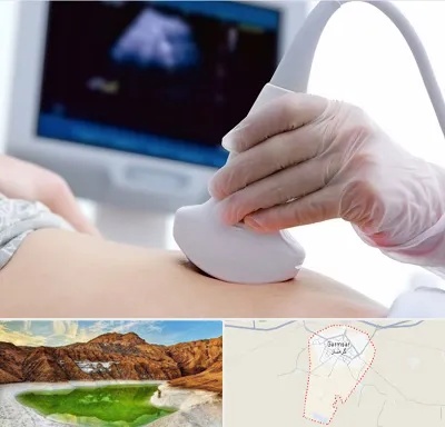 سونوگرافی در گرمسار
