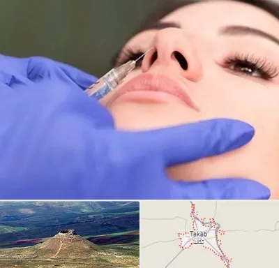 هیالاز در تکاب