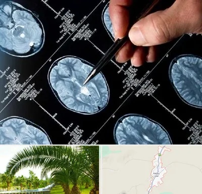 دکتر تشنج در کهنوج