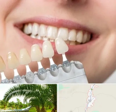 مرکز کامپوزیت دندان در کهنوج