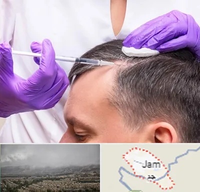 دکتر فوق تخصص پوست و مو در جم