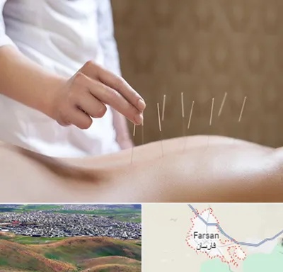 درای نیدلینگ در فارسان