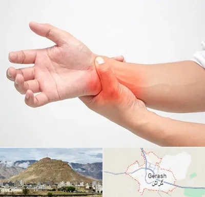 دکتر متخصص دست در گراش