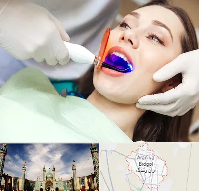 دندانپزشکی بدون درد در آران و بیدگل
