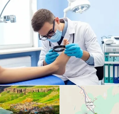 درمان زخم پای دیابتی در عجب شیر