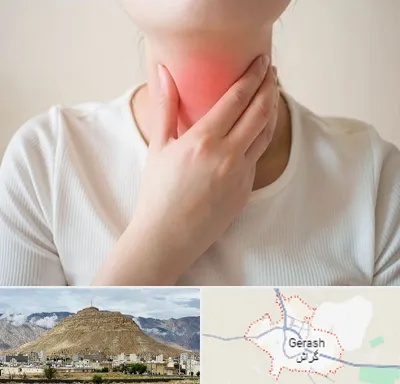 دکتر سرطان مری در گراش