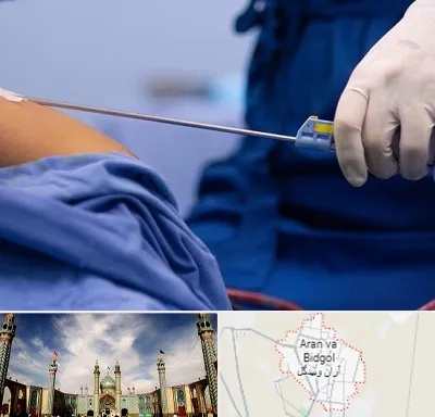 پیکر تراشی در آران و بیدگل