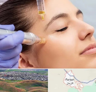 میکرونیدلینگ در فارسان