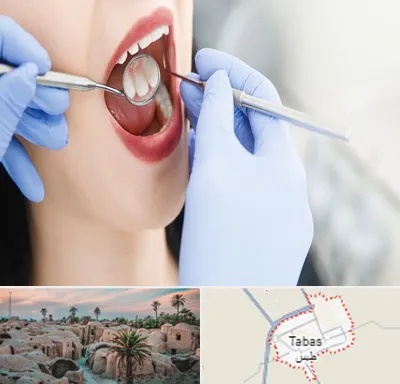 جراح دندان عقل در طبس