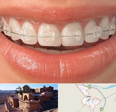 ارتودنسی اقساطی در قائن