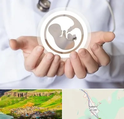 کلینیک ناباروری در عجب شیر