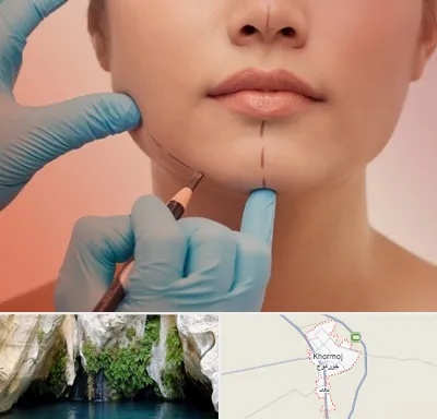 دکتر زیبایی خانم در خورموج