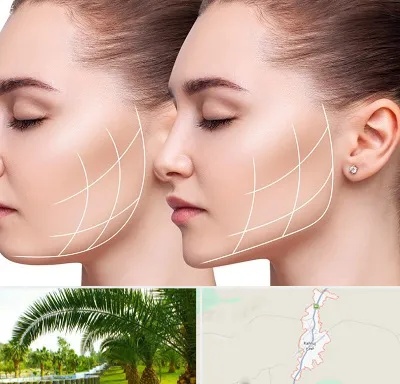 جراحی بوکال فت در کهنوج