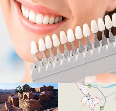 متخصص لمینت دندان در قائن
