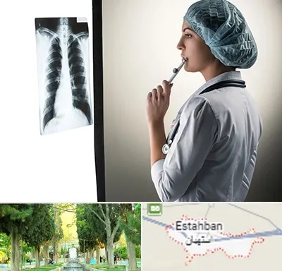 دکتر سرطان ریه در استهبان