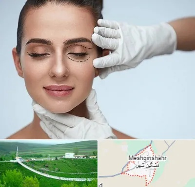 عمل پف چشم در مشگین شهر
