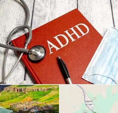 دکتر adhd (بیش فعالی بزرگسالان) در عجب شیر