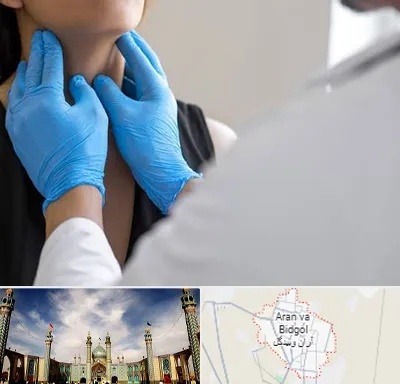 دکتر سرطان گلو در آران و بیدگل