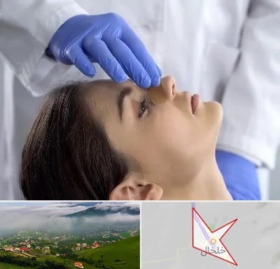 عمل بینی عروسکی در خلخال