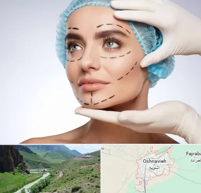 جراحی زیبایی در اشنویه