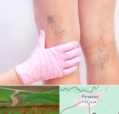 دکتر فوق تخصص واریس در پارس آباد