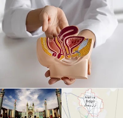 دکتر دستگاه تناسلی مردان در آران و بیدگل