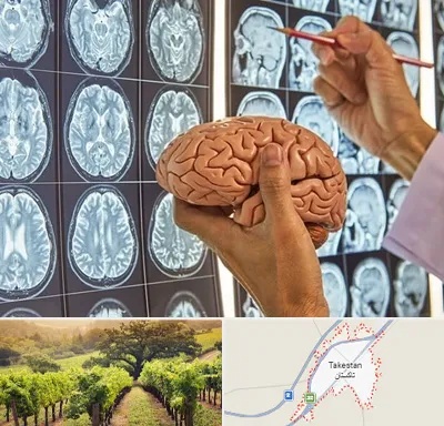 دکتر فوق تخصص جراح مغز و اعصاب در تاکستان
