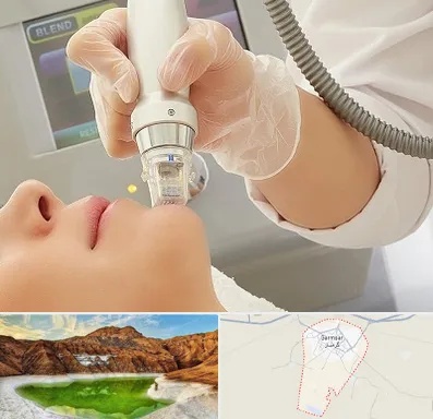آر اف فرکشنال در گرمسار