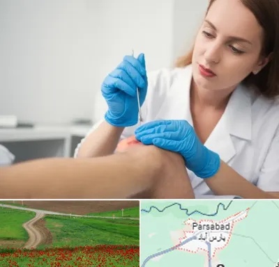 متخصص زخم در پارس آباد