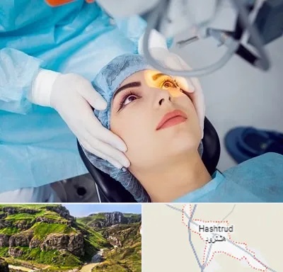 دکتر عمل لیزیک چشم در هشترود