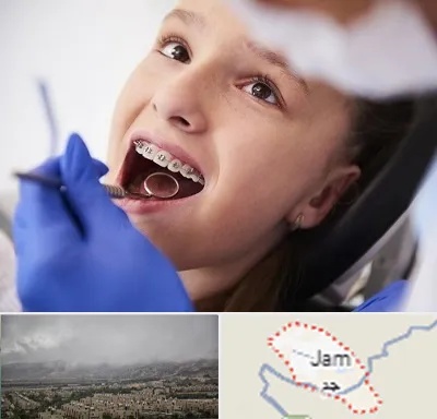 دکتر ارتودنسی کودکان در جم