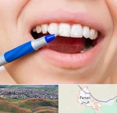 دندانسازی ارزان در فارسان