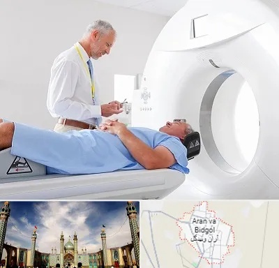 سی تی اسکن در آران و بیدگل
