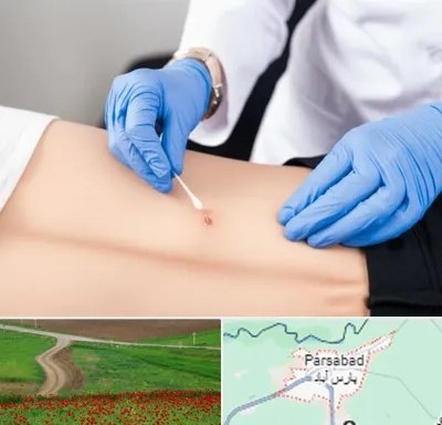 متخصص زخم بستر در پارس آباد