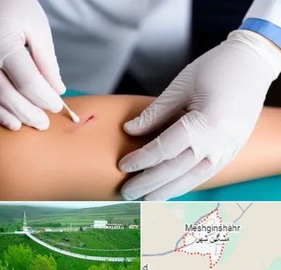 متخصص زخم عفونی در مشگین شهر