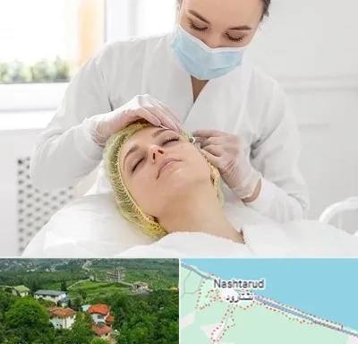 کلینیک زیبایی در نشتارود