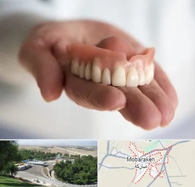 لیفت لثه با لیزر در مبارکه