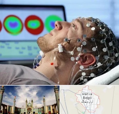 مرکز نوار مغز در آران و بیدگل