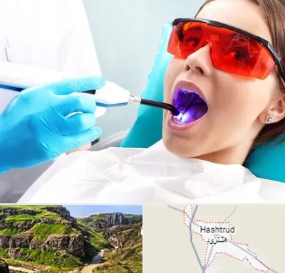 جراحی لثه با لیزر در هشترود