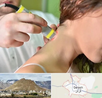 لیزر درمانی در گراش