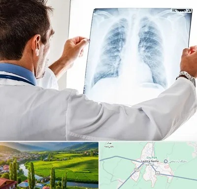 دکتر متخصص ریه در لشت نشا