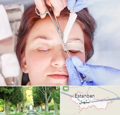 جراحی پلک افتاده در استهبان